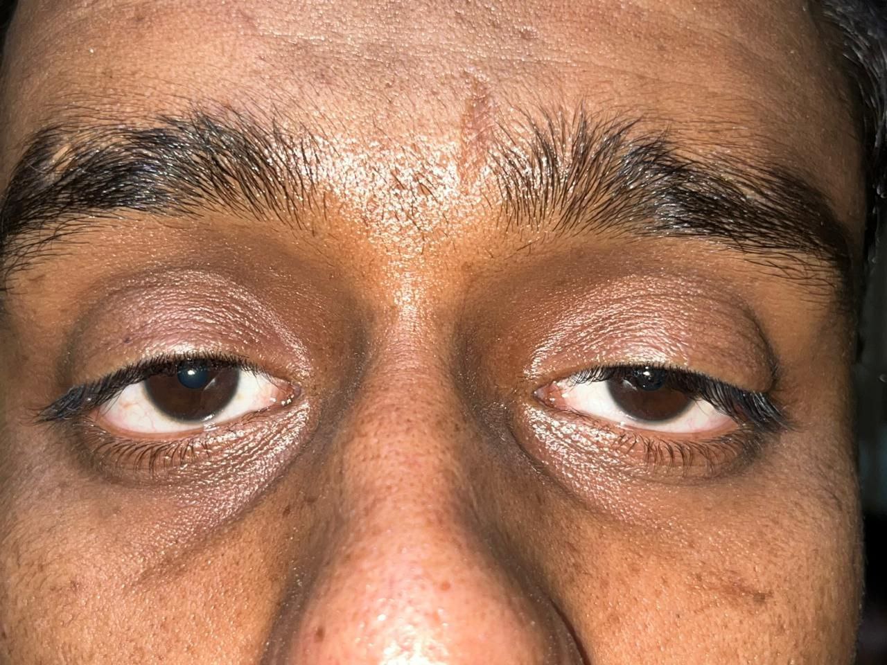 5 before