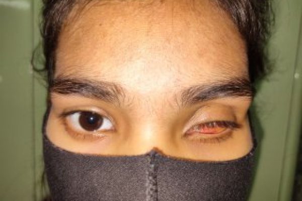 10 before
